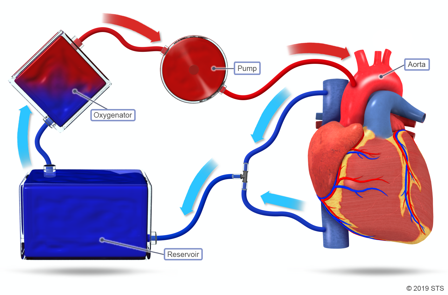 state-of-the-art-coronary-artery-bypass-graft-surgery